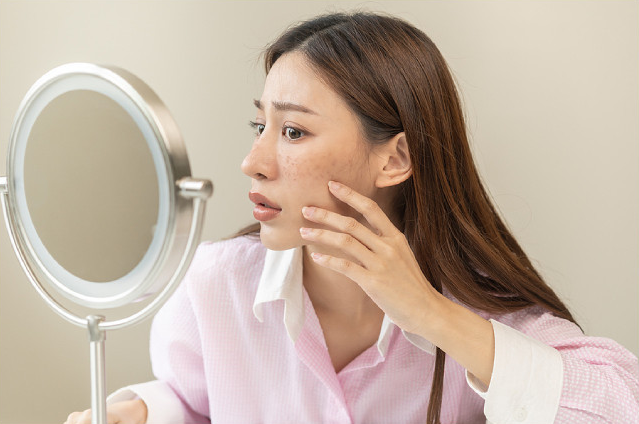 Common Causes Of Dark Spots And How To Treat Them